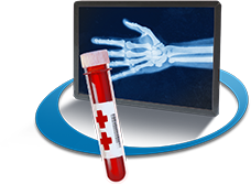 Hand x-ray and blood vial of a patient